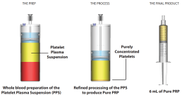 pure-prp-process